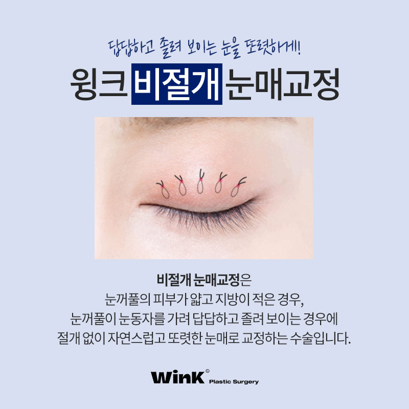 윙크성형외과 비절개 or 절개 눈매교정! 나에게 맞는 눈매교정은? 관련 이미지 4