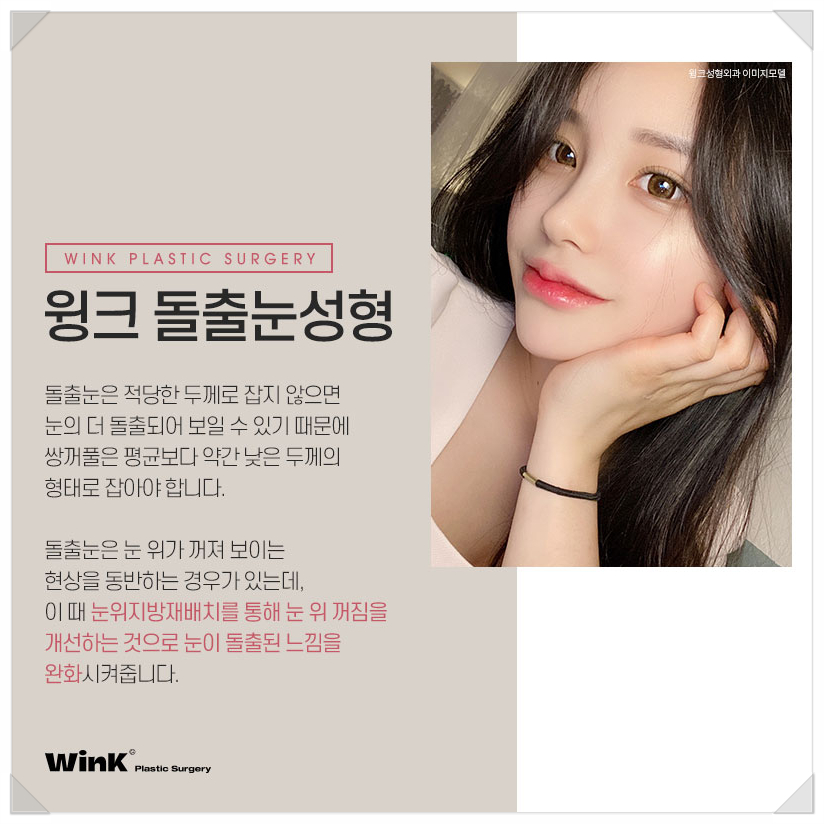 Post-Op Review of Protruding Eyes Surgery, Sunken Eye Fat Grafting, Wink Plastic Surgery Upper Eyelid Fat Repositioning Price, Protruding Eye Fat Grafting image 4