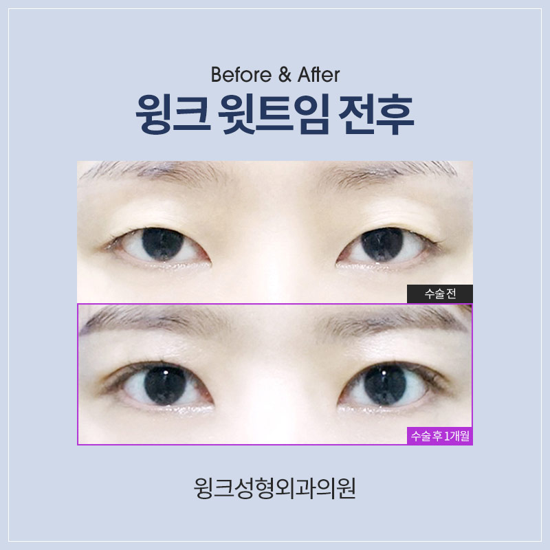윗트임에 대해 알아보겠습니다. 관련 이미지 5