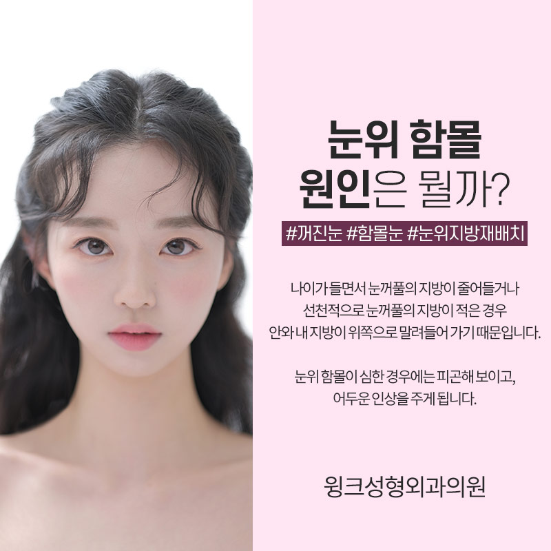 눈위 지방재배치에 대해 알아보겠습니다. 관련 이미지 3