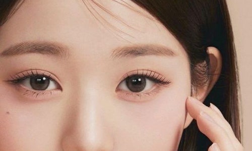 Let’s Take a Look at the Types of Double Eyelids. image 4