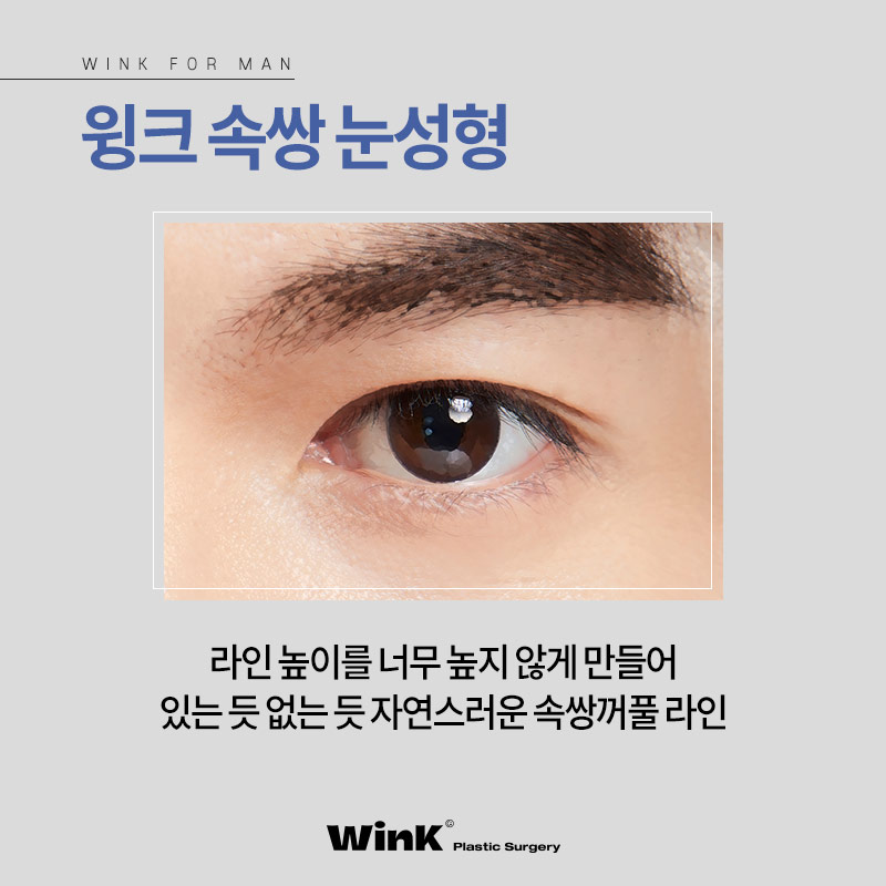 신사남자쌍꺼풀 남자는 무조건 무쌍? 신사역남자눈성형후기 관련 이미지 5