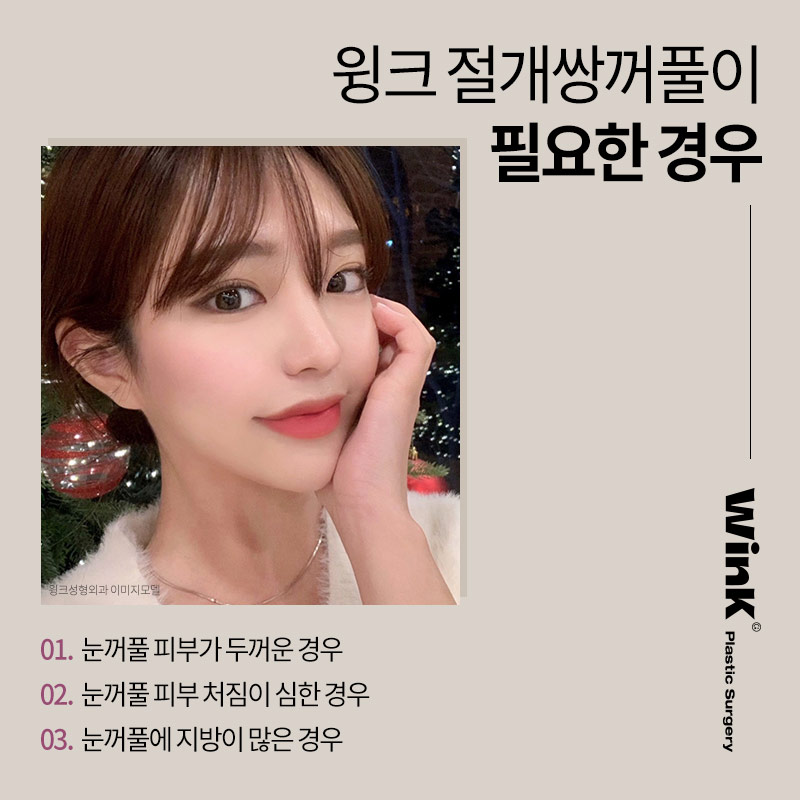 윙크성형외과 절개쌍꺼풀 또렷하면서도 선명한 라인으로 관련 이미지 5
