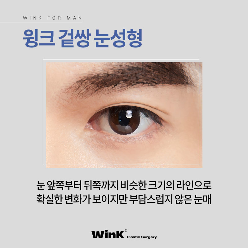 신사남자쌍꺼풀 남자는 무조건 무쌍? 신사역남자눈성형후기 관련 이미지 6