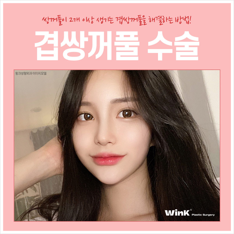 겹주름쌍꺼풀 겹쌍 쌍꺼풀여러겹 겹쌍꺼풀수술은 윙크성형외과! 관련 이미지 7
