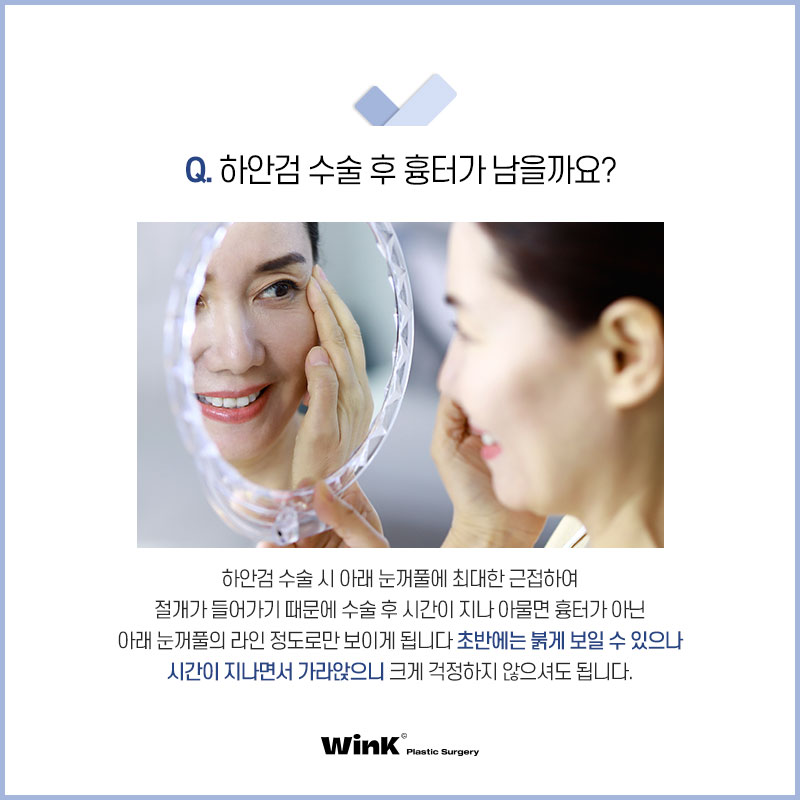 하안검, 눈밑지방재배치 뭐가 다른 거야? 윙크성형외과에서 알려드리는 하안검 수술의 모든 것! 관련 이미지 4