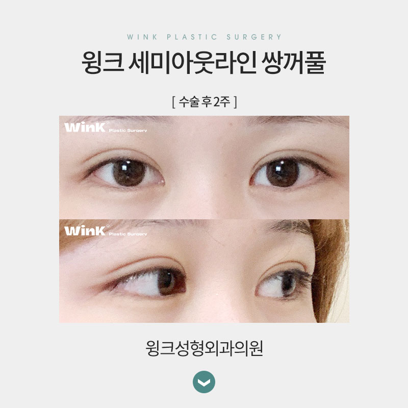 세미아웃 연예인 누가 있을까? 관련 이미지 8