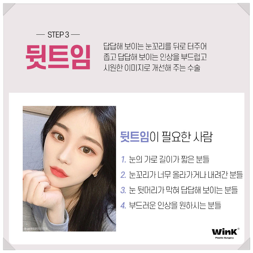 If You’re Looking Into Eye Widening Procedures: Wink Plastic Surgery’s Epicanthoplasty Price, Upper Canthoplasty Before and After, Rear Canthoplasty Reviews, and Where to Get Lower Canthoplasty Well Done image 5