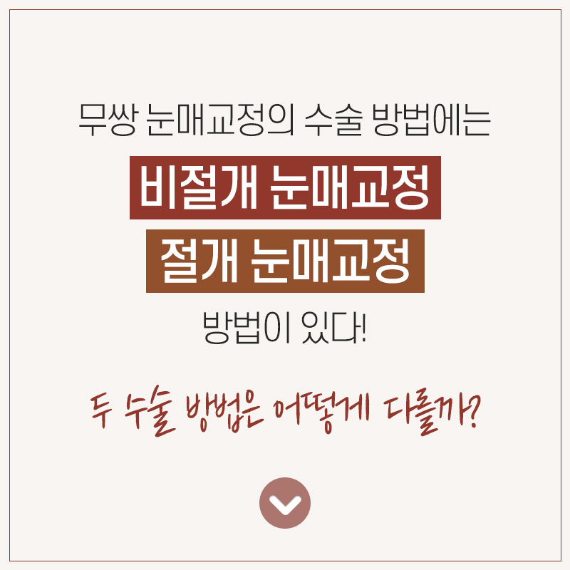 윙크 무쌍 눈매교정으로 쌍꺼풀 라인 없이  또렷한 눈매! 관련 이미지 5