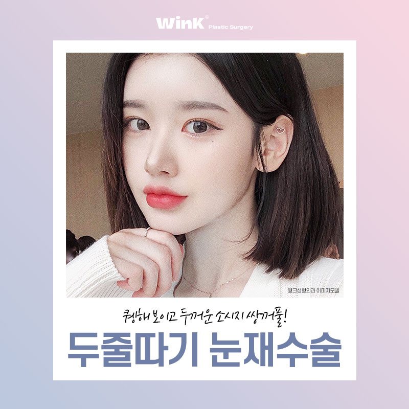 Thick, High Double Eyelid Lines and a Sausage-Like Eye! Solve It with Wink Double-Line Revision Surgery! image 1