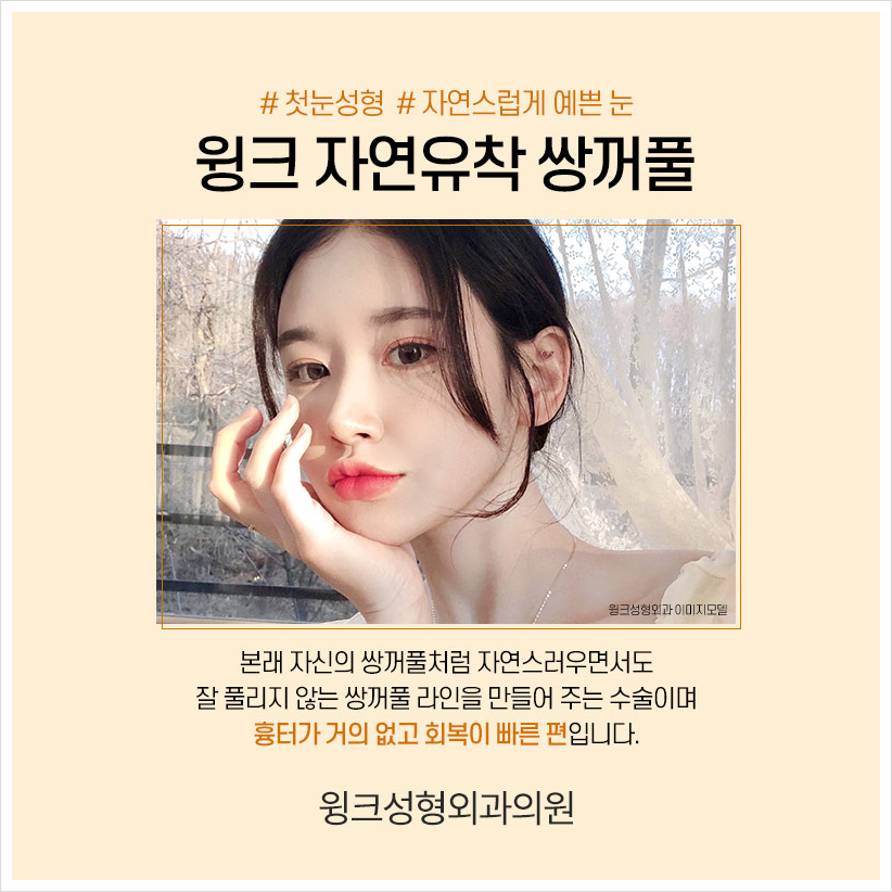 인라인쌍꺼풀 윙크성형외과 자연유착쌍꺼풀후기 자연유착법 관련 이미지 2