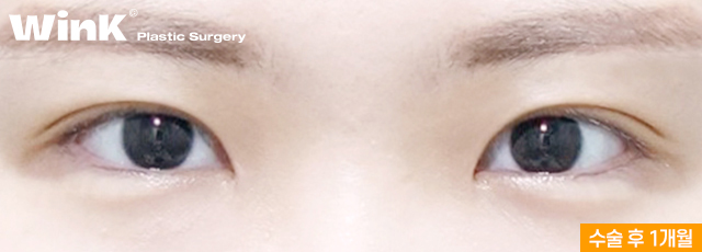 A Natural, Smooth Curved Line That Suits My Eyes! image 7