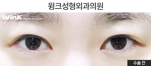 듀얼트임으로 자연스럽게 눈을 키우는 방법에 대해 알아볼까요? 관련 이미지 2
