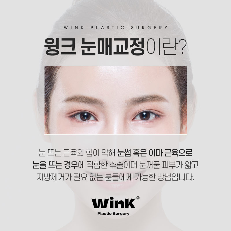 Wink Plastic Surgery Eye Correction for a Natural Look That Doesn't Stand Out image 2