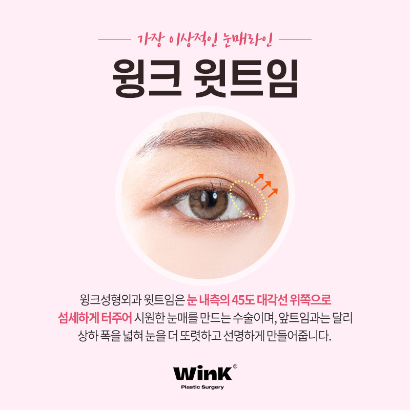 Subtly Enhancing the Eyes with Wink Plastic Surgery’s Upper Epicanthoplasty! image 2