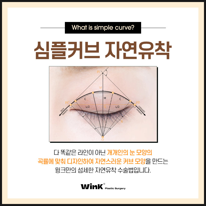 Shinsa Natural Adhesion Double Eyelid Review | Natural Adhesion Double Eyelid Surgery | Wink Plastic Surgery | Natural Adhesion Double Eyelids image 2