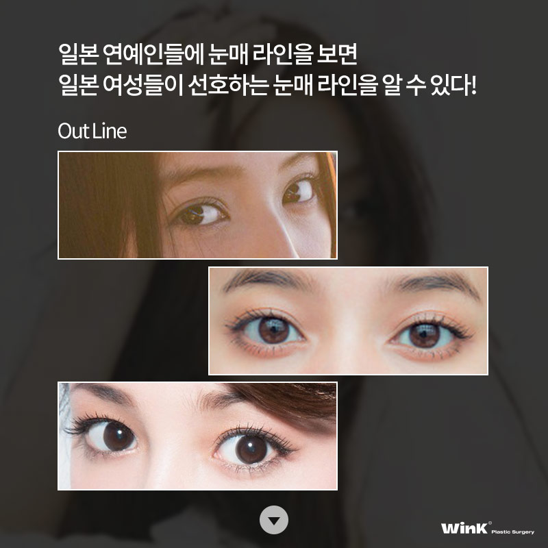 Coming to Korea from Japan for Plastic Surgery? WinK Plastic Surgery Explains the Japanese Double-Eyelid Line Preferred by Japanese Women! image 4