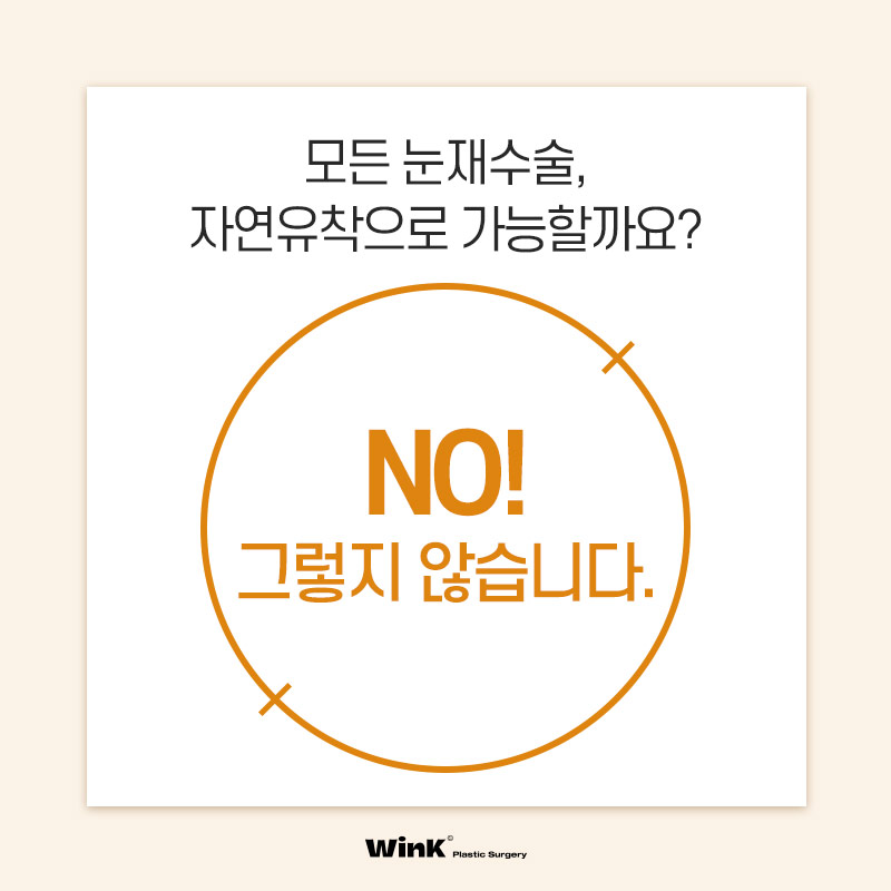 나도 자연유착으로 재수술 할 수 있을까? 관련 이미지 2
