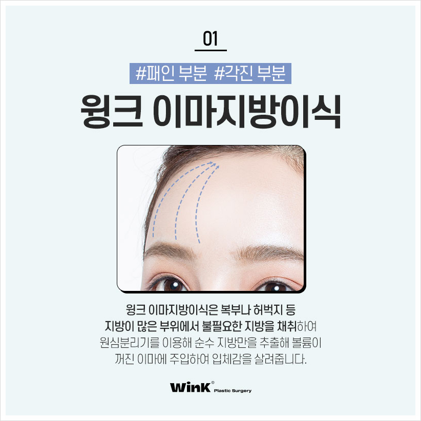 꺼진이마 납작이마 고민이라면? 윙크성형외과 이마볼륨 신사이마지방이식 이마지방이식전후 관련 이미지 2