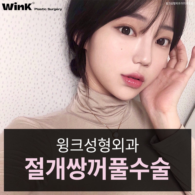 윙크성형외과 절개쌍꺼풀 또렷하면서도 선명한 라인으로 관련 이미지 6
