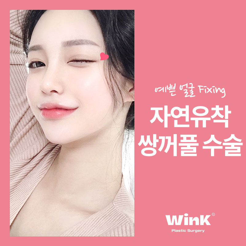 윙크성형외과 자연유착쌍꺼풀후기 쌍수잘하는곳 관련 이미지 1