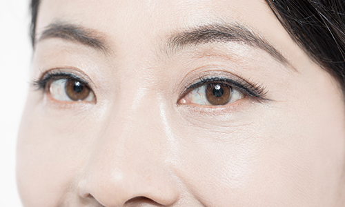 상안검 수술, 자연스러운 결과를 얻으려면 관련 이미지 2