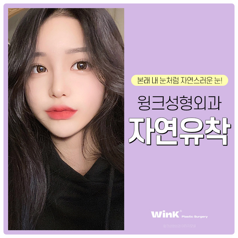 자연유착쌍꺼풀후기 자연유착법 윙크성형외과 자연유착쌍꺼풀비용 관련 이미지 1