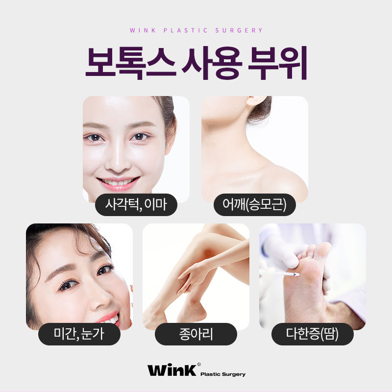 Places That Are Good for Jaw Botox: Wrinkle Botox Pricing, as Told by Wink Plastic Surgery! image 3