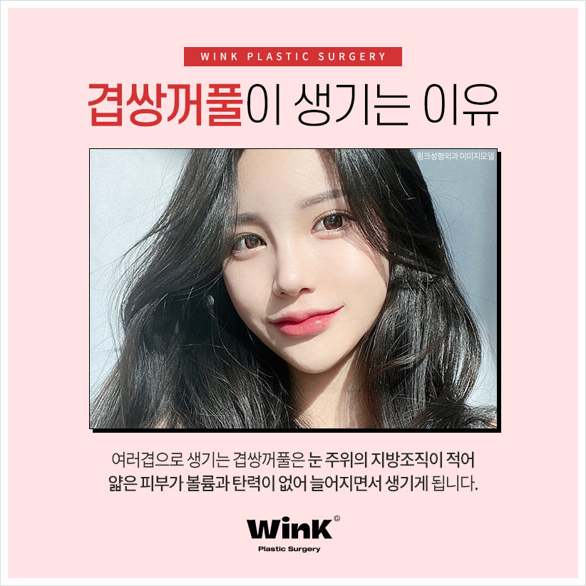 겹주름쌍꺼풀 겹쌍 쌍꺼풀여러겹 겹쌍꺼풀수술은 윙크성형외과! 관련 이미지 3
