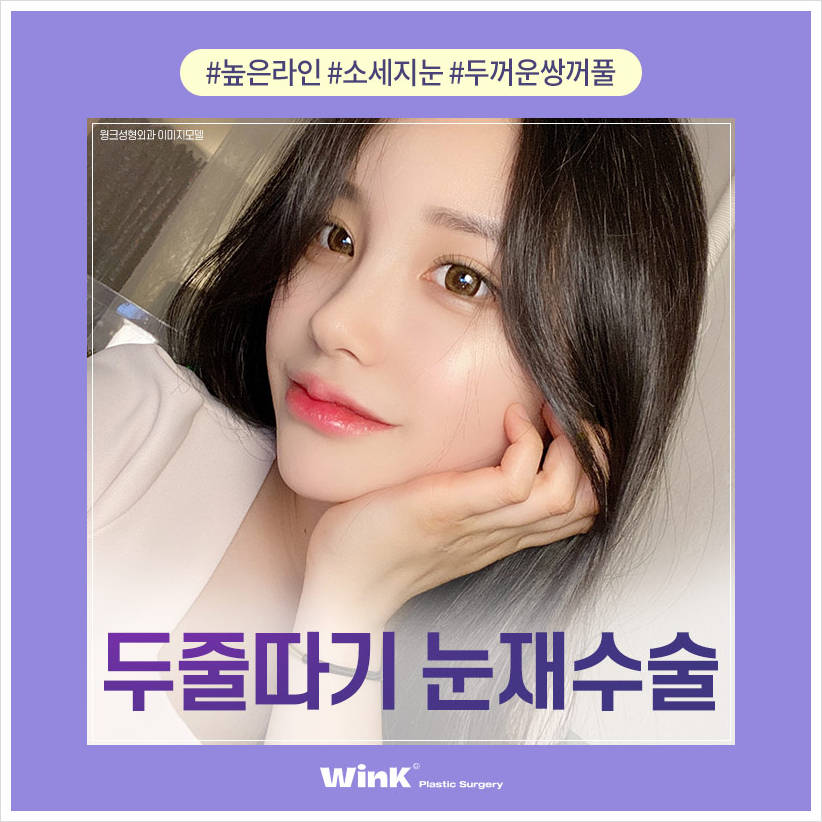 쌍꺼풀재수술 두줄따기눈재수술 윙크성형외과 소세지눈재수술 관련 이미지 1