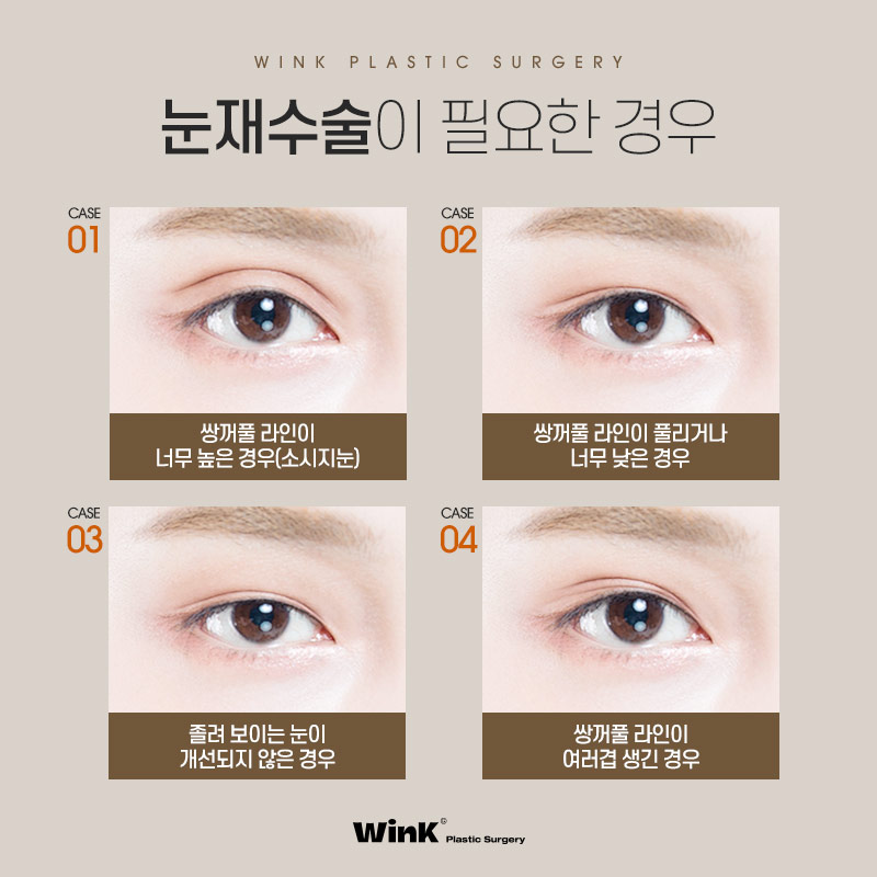 Does double-eyelid surgery with an incision always leave a scar? Revision eyelid surgery scars explained by Wink Plastic Surgery Clinic! image 2