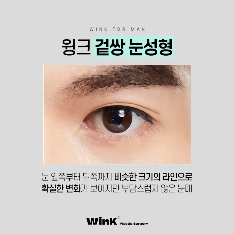 Sinsa Station Male Eye Surgery, What Kind of Eyes Suit Me? image 6