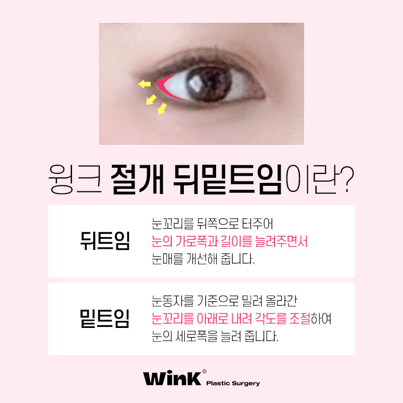 신사트임잘하는곳?  윙크성형외과 절개뒤밑트임후기! 관련 이미지 3