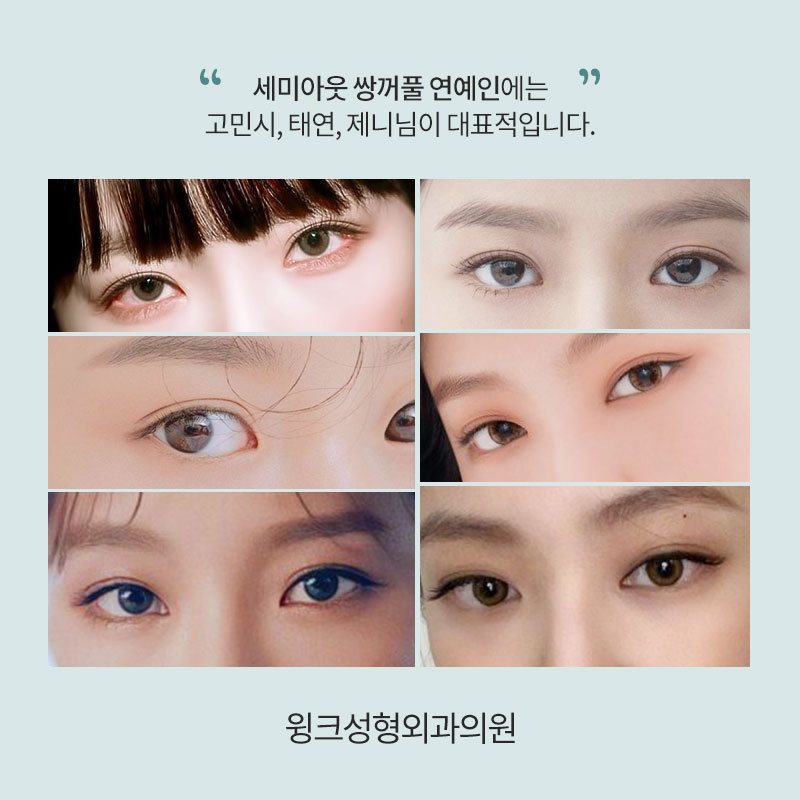 세미아웃 연예인 누가 있을까? 관련 이미지 3
