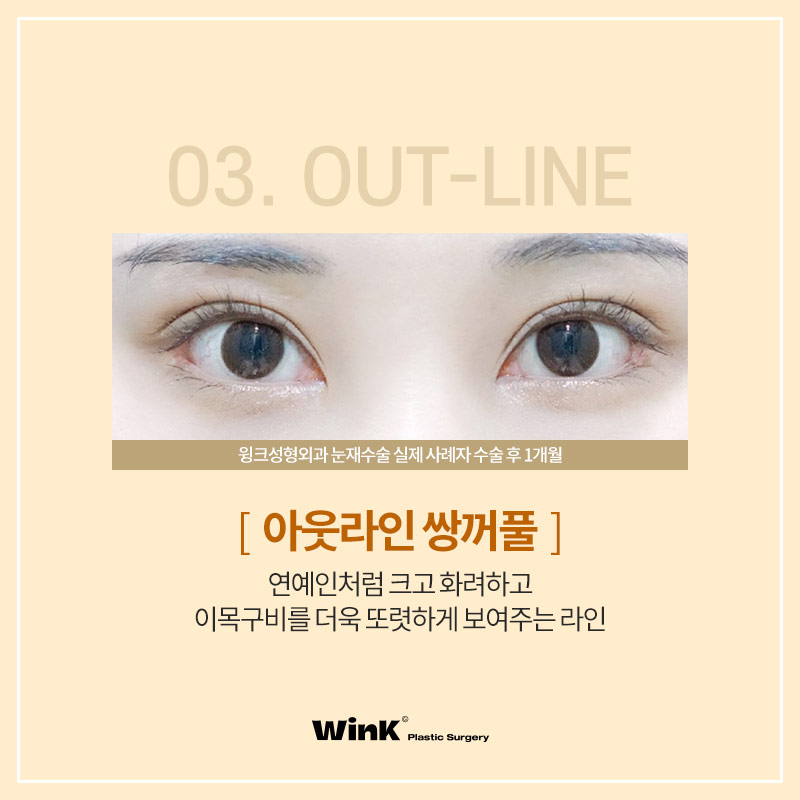 Let’s Learn About the Types of Double Eyelid Lines image 5