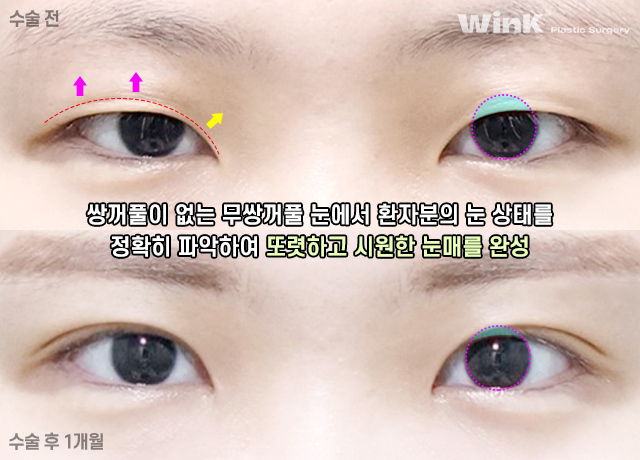 A Natural, Smooth Curved Line That Suits My Eyes! image 10