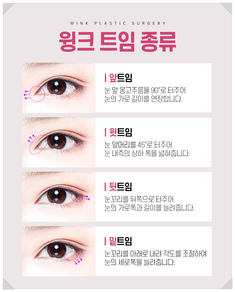If You’re Looking Into Eye Widening Procedures: Wink Plastic Surgery’s Epicanthoplasty Price, Upper Canthoplasty Before and After, Rear Canthoplasty Reviews, and Where to Get Lower Canthoplasty Well Done image 2