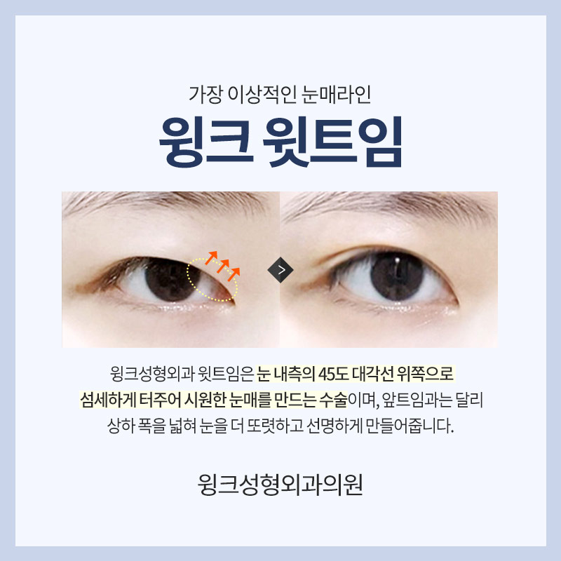 윗트임에 대해 알아보겠습니다. 관련 이미지 2