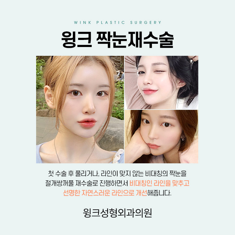 짝눈 쌍꺼풀 재수술에 관해 알아보겠습니다. 관련 이미지 2