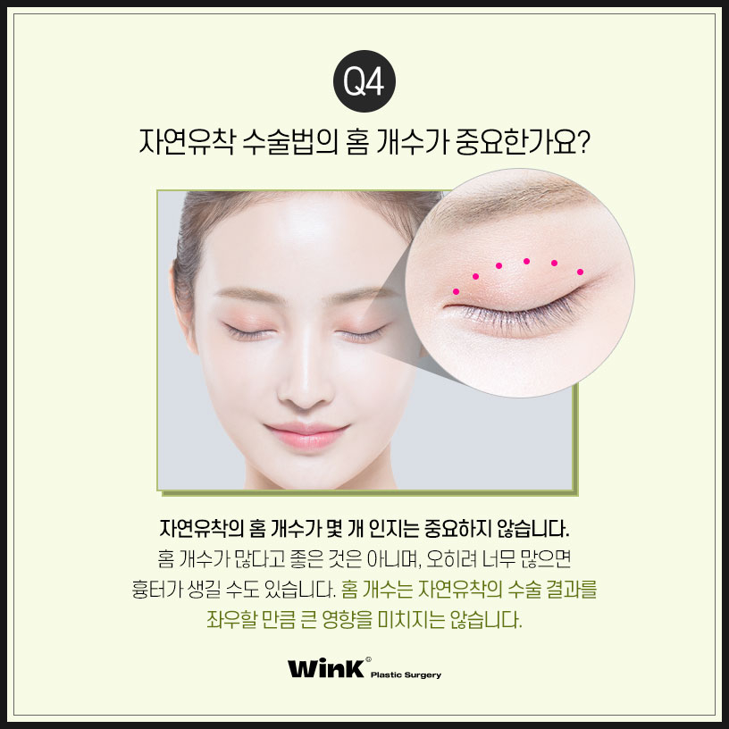 쌍수자연유착의 모든것 윙크에서 알려드려요 자연유착쌍꺼풀후기 쌍꺼풀수술잘하는곳 관련 이미지 6