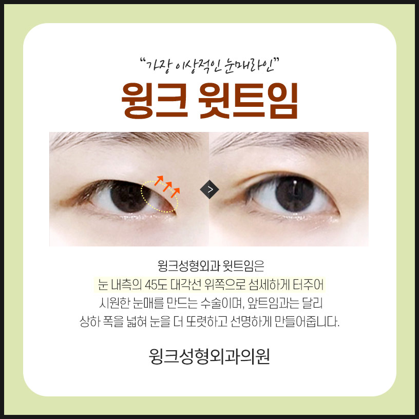 트임성형 윗트임으로 전체적으로 눈을 시원하게! 관련 이미지 2