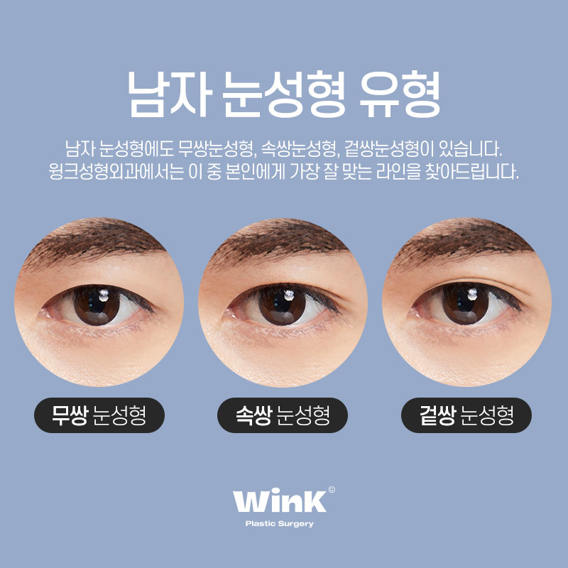 Monolid, inner double eyelid, or outer double eyelid? Choose the line that suits you! Men’s eye surgery at Wink Plastic Surgery image 6