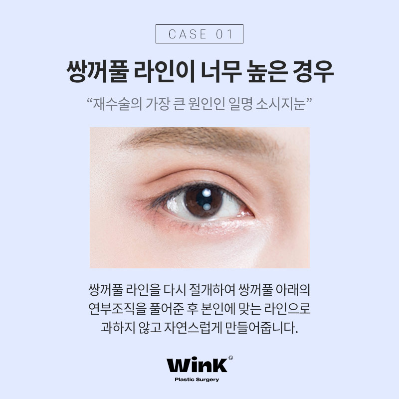 Types of Double Eyelid Revision Surgery and Solutions at Wink Plastic Surgery, Sinsa Station image 3
