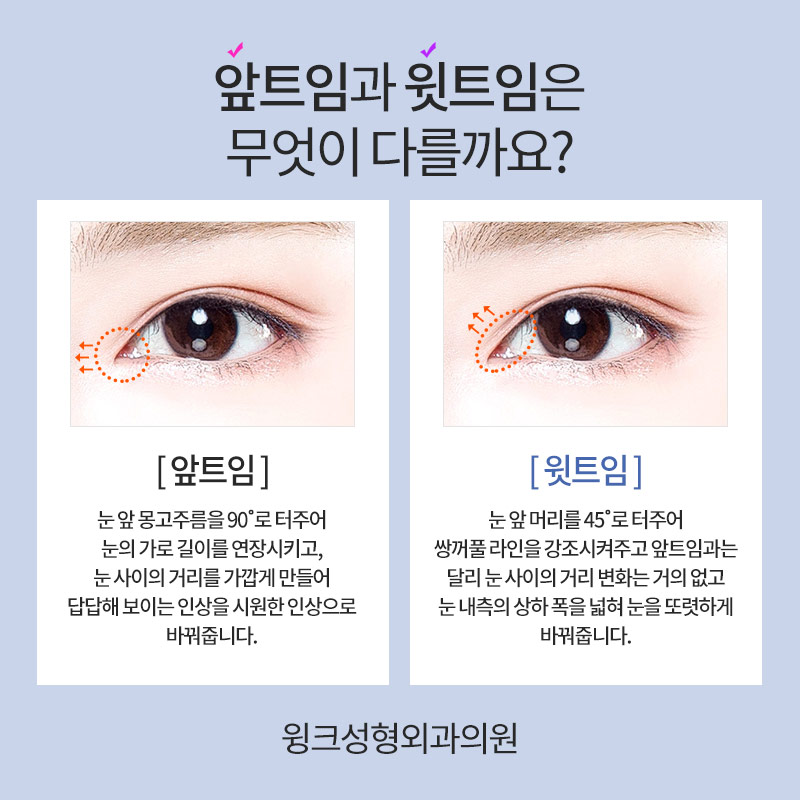 윗트임에 대해 알아보겠습니다. 관련 이미지 4