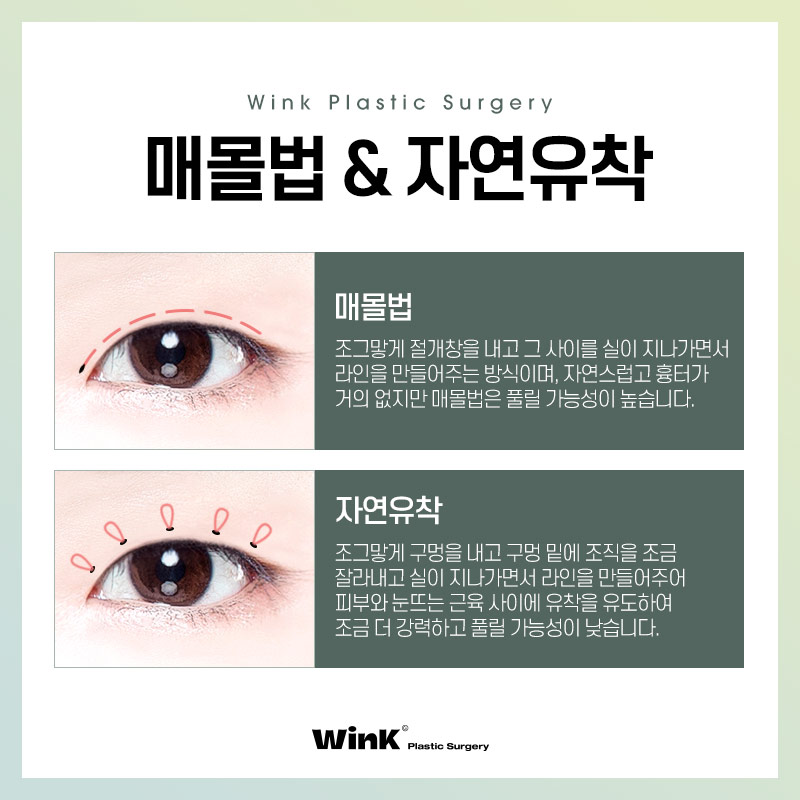 윙크성형외과만의 심플커브 자연유착으로 자연스럽고 매끈한 곡선 라인! 관련 이미지 3