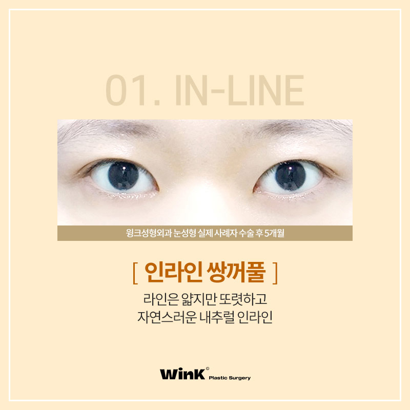 Let’s Learn About the Types of Double Eyelid Lines image 3