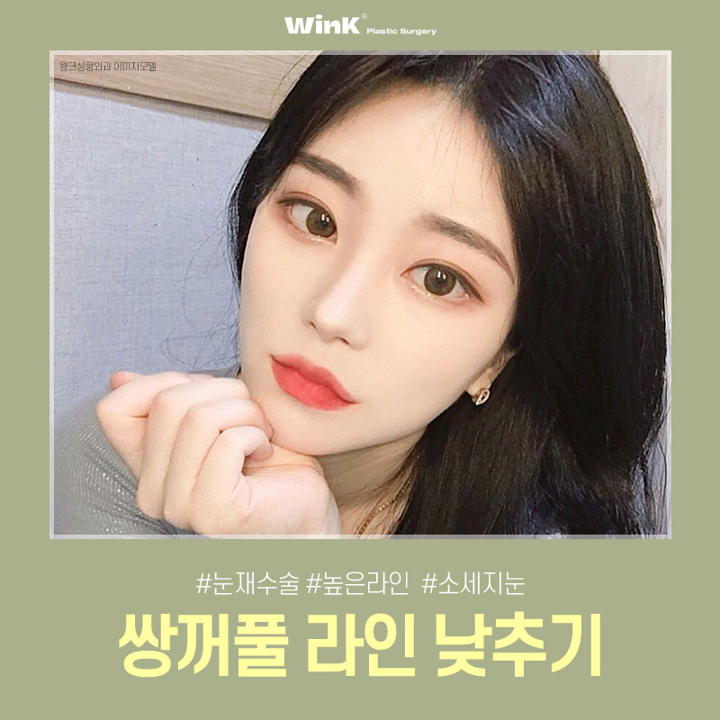 부담스러운 소세지눈? 윙크성형외과 두줄따기 쌍꺼풀 라인낮추기로 호감형 이미지로! 관련 이미지 1