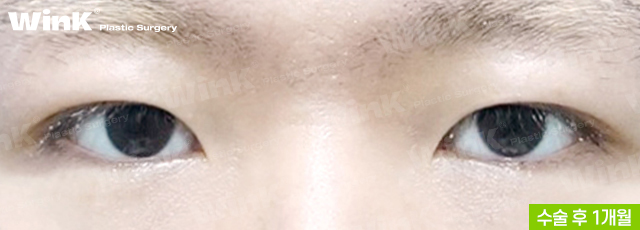 What Eye Shape Do Men Prefer? image 4