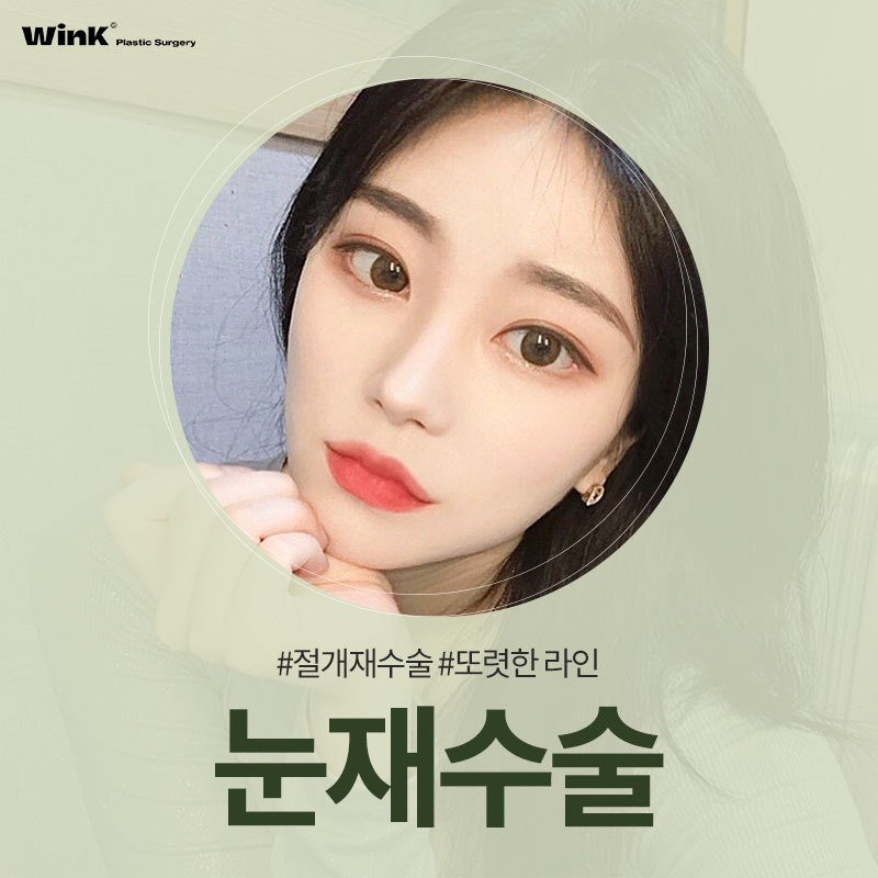 Let’s Take a Look at What to Consider When Undergoing Revision Double Eyelid Surgery. image 1
