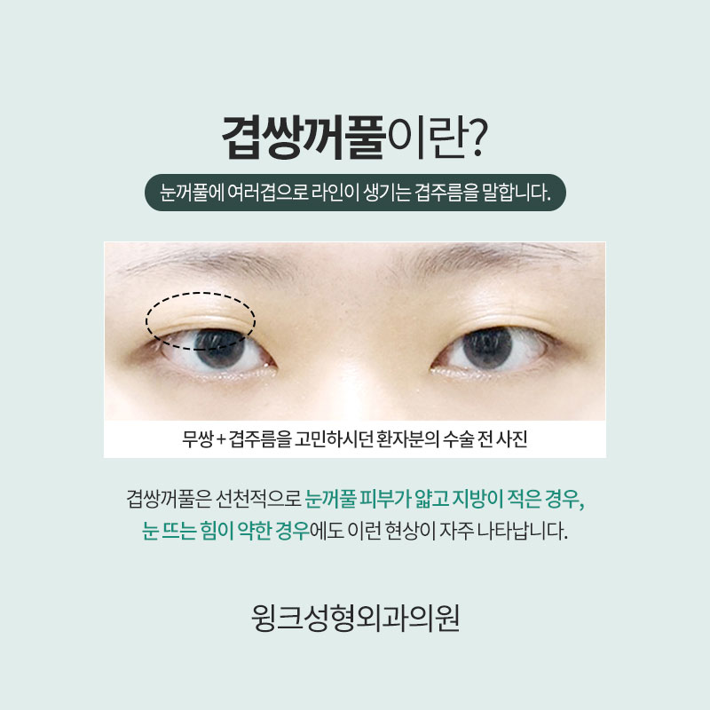 Resolve Double Eyelid Fold Creases with Natural Adhesion for a Clean, Defined Line! image 3